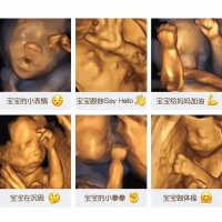 孕妈妈在哭，胎儿会难过吗？“孕期四维检查”告诉你答案！